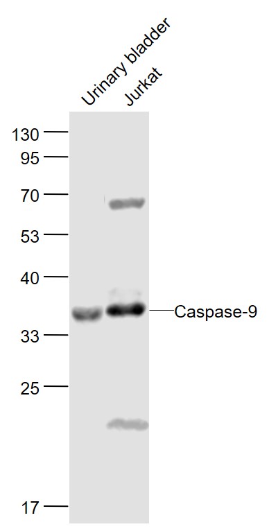 Lane 1: Mouse Urinary bladder lysates; Lane 2: Human Jurkat cell lysates probed with Caspase-9 Polyclonal Antibody, Unconjugated (bs-20773R) at 1:1000 dilution and 4˚C overnight incubation. Followed by conjugated secondary antibody incubation at 1:20000 for 60 min at 37˚C.