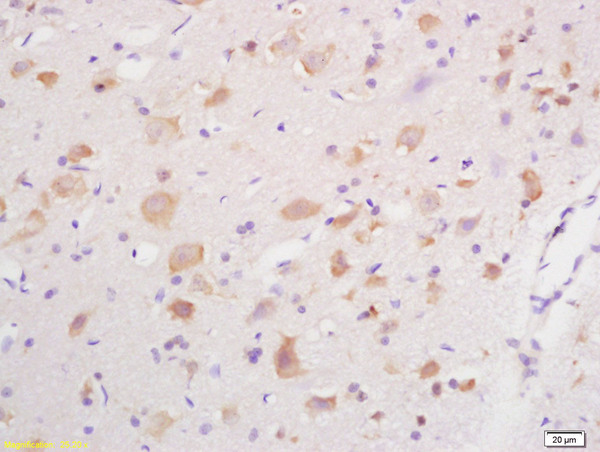 Formalin-fixed and paraffin embedded rat brain labeled with Anti GABRG2\/GABA A Receptor gamma 2 Polyclonal Antibody, Unconjugated (bs-4112R) at 1:200 followed by conjugation to the secondary antibody and DAB staining