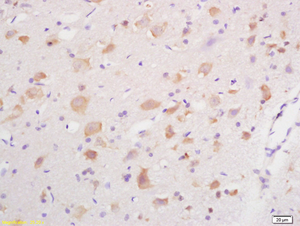 Formalin-fixed and paraffin embedded rat brain labeled with Anti GABRG2/GABA A Receptor gamma 2 Polyclonal Antibody, Unconjugated (bs-4112R) at 1:200 followed by conjugation to the secondary antibody and DAB staining