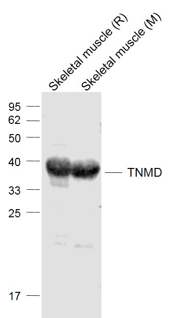 Lane 1: Rat Skeletal muscle lysates; Lane 2: Mouse Skeletal muscle lysates probed with TNMD/Tenomodulin Polyclonal Antibody, Unconjugated (bs-7525R) at 1:1000 dilution and 4˚C overnight incubation. Followed by conjugated secondary antibody incubation at 1:20000 for 60 min at 37˚C. Lane 1: Rat Skeletal muscle lysates; Lane 2: Mouse Skeletal muscle lysates probed with TNMD/Tenomodulin Polyclonal Antibody, Unconjugated (bs-7525R) at 1:1000 dilution and 4˚C overnight incubation. Followed by conjugated secondary antibody incubation at 1:20000 for 60 min at 37˚C.