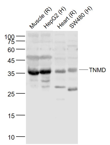 Lane 1: Rat muscle lysates; Lane 2: HepG2 cell lysates; Lane 3: Rat Heart lysates; Lane 4: SW480 cell lysates probed with TNMD/Tenomodulin Polyclonal Antibody, Unconjugated (bs-7525R) at 1:1000 dilution and 4˚C overnight incubation. Followed by conjugated secondary antibody incubation at 1:20000 for 60 min at 37˚C. Lane 1: Rat muscle lysates; Lane 2: HepG2 cell lysates; Lane 3: Rat Heart lysates; Lane 4: SW480 cell lysates probed with TNMD/Tenomodulin Polyclonal Antibody, Unconjugated (bs-7525R) at 1:1000 dilution and 4˚C overnight incubation. Followed by conjugated secondary antibody incubation at 1:20000 for 60 min at 37˚C.