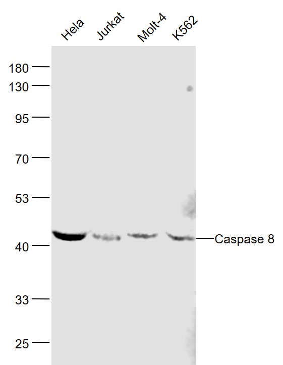 Lane 1: Human Hela cell lysates; Lane 2: Human Jurkat cell lysates; Lane 3: Human MOLT-4 cell lysates; Lane 4: Human K562 cell lysates probed with Caspase 8 Monoclonal Antibody, Unconjugated (bsm-33190M) at 1:1000 dilution and 4˚C overnight incubation. Followed by conjugated secondary antibody incubation at 1:20000 for 60 min at 37˚C.
