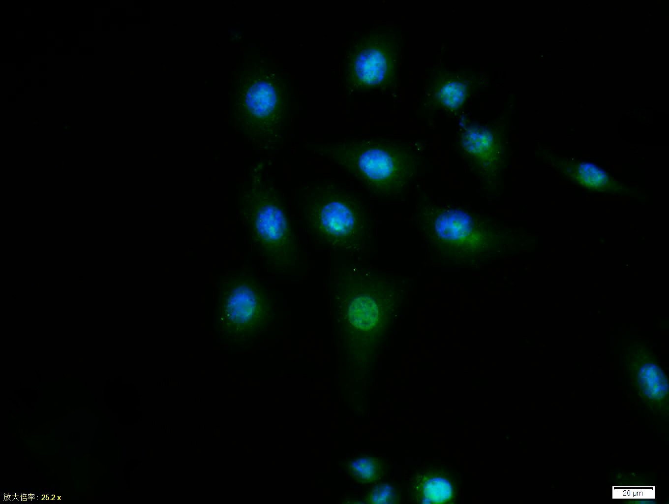 Tissue\/cell:MCF7 cell; 4% Paraformaldehyde-fixed; Triton X-100 at room temperature for 20 min; Blocking buffer (normal goat serum, C-0005) at 37\u00b0C for 20 min; Antibody incubation with (Cyclin D1) polyclonal Antibody, Unconjugated (bs-0623R) 1:100, 90 minutes at 37\u00b0C; followed by a FITC conjugated Goat Anti-Rabbit IgG antibody at 37\u00b0C for 90 minutes, DAPI (blue, C02-04002) was used to stain the cell nuclei.