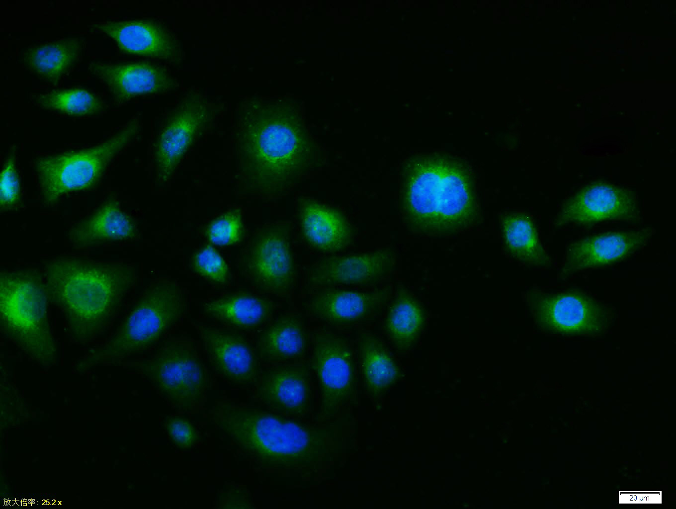Tissue/cell:MCF7 cell; 4% Paraformaldehyde-fixed; Triton X-100 at room temperature for 20 min; Blocking buffer (normal goat serum, C-0005) at 37°C for 20 min; Antibody incubation with (c-fos) polyclonal Antibody, Unconjugated (bs-0469R) 1:100, 90 minutes at 37°C; followed by a FITC conjugated Goat Anti-Rabbit IgG antibody at 37°C for 90 minutes, DAPI (blue, C02-04002) was used to stain the cell nuclei.