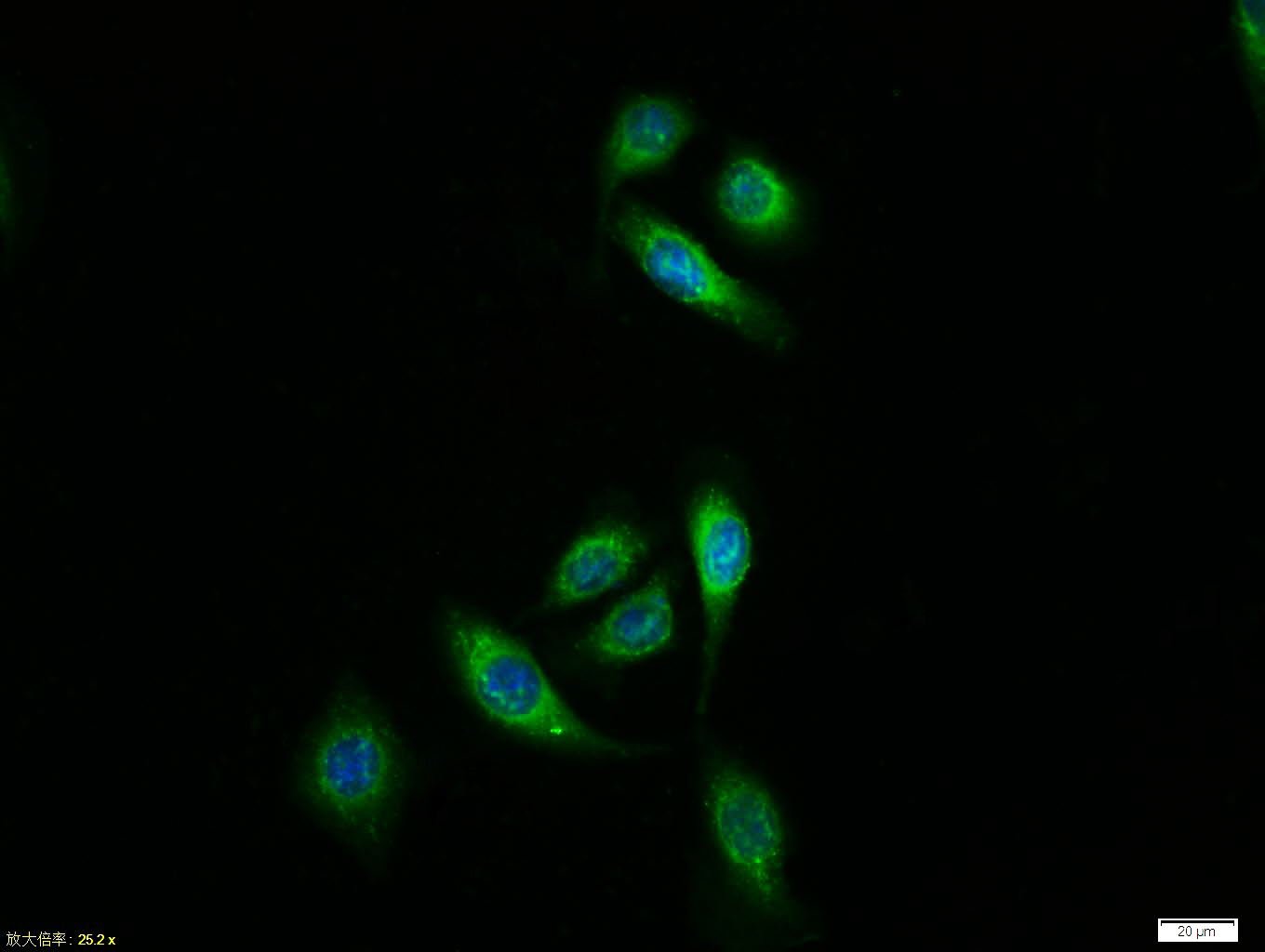 Tissue/cell:MCF7 cell; 4% Paraformaldehyde-fixed; Triton X-100 at room temperature for 20 min; Blocking buffer (normal goat serum, C-0005) at 37°C for 20 min; Antibody incubation with (Estrogen receptor alpha) polyclonal Antibody, Unconjugated (bs-0254R) 1:100, 90 minutes at 37°C; followed by a FITC conjugated Goat Anti-Rabbit IgG antibody at 37°C for 90 minutes, DAPI (blue, C02-04002) was used to stain the cell nuclei.