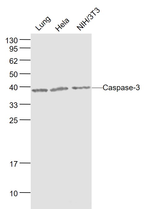 Lane 1: Mouse Lung lysates; Lane 2: Human Hela cell lysates; Lane 3: Mouse NIH/3T3 cell lysates probed with Caspase 3 Polyclonal Antibody, Unconjugated (bs-0081R) at 1:1000 dilution and 4˚C overnight incubation. Followed by conjugated secondary antibody incubation at 1:20000 for 60 min at 37˚C.