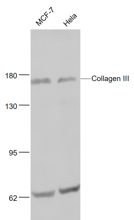Lane 1: Human MCF-7 cell lysates; Lane 2: Human Hela cell lysates probed with Collagen 3 Polyclonal Antibody, Unconjugated (bs-0549R) at 1:1000 dilution and 4˚C overnight incubation. Followed by conjugated secondary antibody incubation at 1:20000 for 60 min at 37˚C.