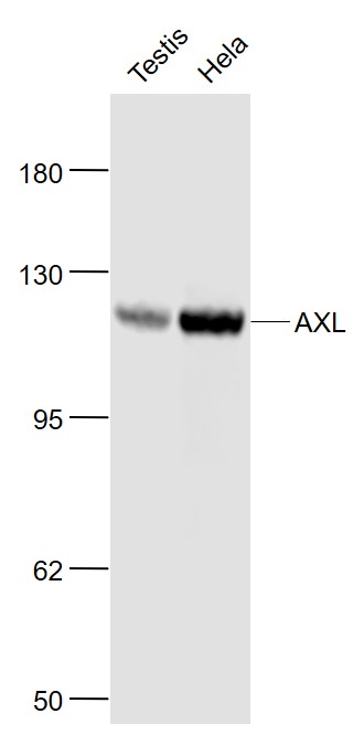 Lane 1: Mouse Testis lysates; Lane 2:Human Hela cell lysates probed with AXL Polyclonal Antibody, Unconjugated (bs-5180R) at 1:1000 dilution and 4˚C overnight incubation. Followed by conjugated secondary antibody incubation at 1:20000 for 60 min at 37˚C.