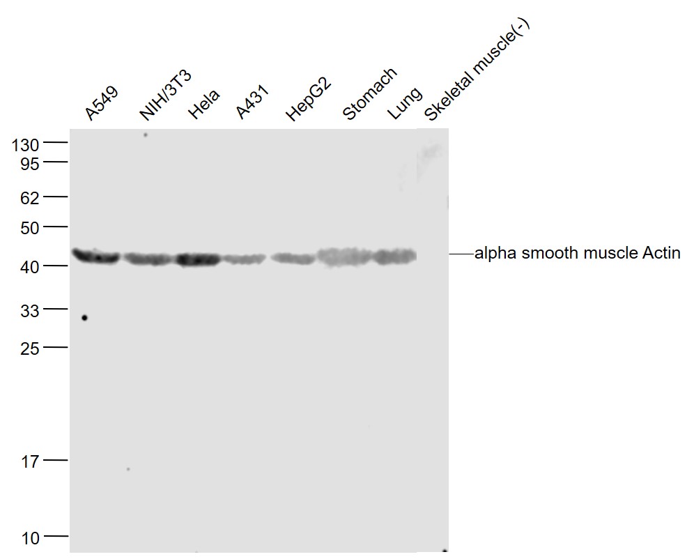 Lane 1: Human A549 cell lysates; Lane 2: Mouse NIH/3T3 cell lysates; Lane 3: Human Hela cell lysates; Lane 4: Human A431 cell lysates; Lane 5: Human HepG2 cell lysates; Lane 6: Mouse Stomach lysates; Lane 7: Mouse Lung lysates; Lane 8: Mouse Skeletal muscle lysates probed with Pan-Actin Polyclonal Antibody, Unconjugated (bs-10196R) at 1:1000 dilution and 4˚C overnight incubation. Followed by conjugated secondary antibody incubation at 1:20000 for 60 min at 37˚C.