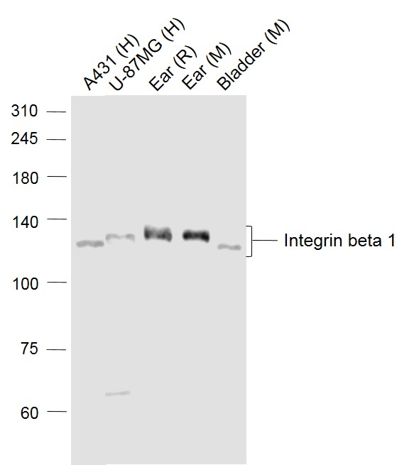 Lane 1: Human A431 cell lysates; Lane 2: Human U-87MG cell lysates; Lane 3: Rat Ear lysates; Lane 4: Mouse Ear lysates; Lane 5: Mouse Urinary bladder lysates probed with Integrin beta 1 Polyclonal Antibody, Unconjugated (bs-0486R) at 1:1000 dilution and 4˚C overnight incubation. Followed by conjugated secondary antibody incubation at 1:20000 for 60 min at 37˚C.