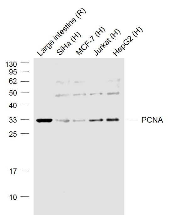 Lane 1:Rat Large intestine lysates; Lane 2: Human  Siha cell lysates; Lane 3: Human MCF-7 cell lysates; Lane 4: Human Jurkat cell lysates; Lane 5: Human HepG2 cell lysates probed with PCNA Polyclonal Antibody, Unconjugated (bs-0754R) at 1:1000 dilution and 4˚C overnight incubation. Followed by conjugated secondary antibody incubation at 1:20000 for 60 min at 37˚C.