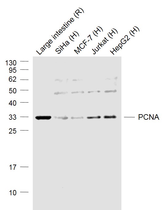 Lane 1:Rat Large intestine lysates; Lane 2: Human Siha cell lysates; Lane 3: Human MCF-7 cell lysates; Lane 4: Human Jurkat cell lysates; Lane 5: Human HepG2 cell lysates probed with PCNA Polyclonal Antibody, Unconjugated (bs-0754R) at 1:1000 dilution and 4˚C overnight incubation. Followed by conjugated secondary antibody incubation at 1:20000 for 60 min at 37˚C.