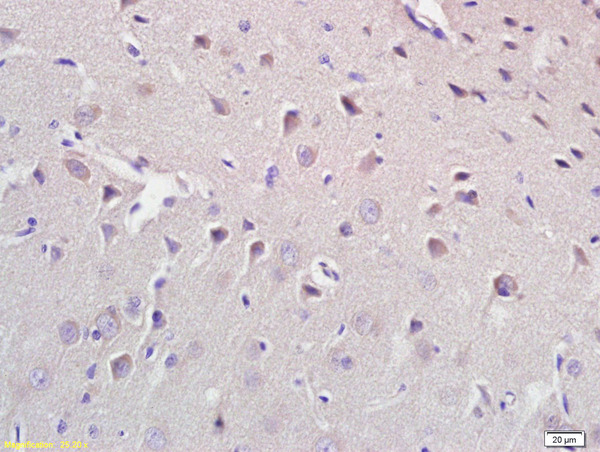 Formalin-fixed and paraffin embedded rat brain labeled with Anti CROT Polyclonal Antibody, Unconjugated (bs-5048R) at 1:200 followed by conjugation to the secondary antibody and DAB staining