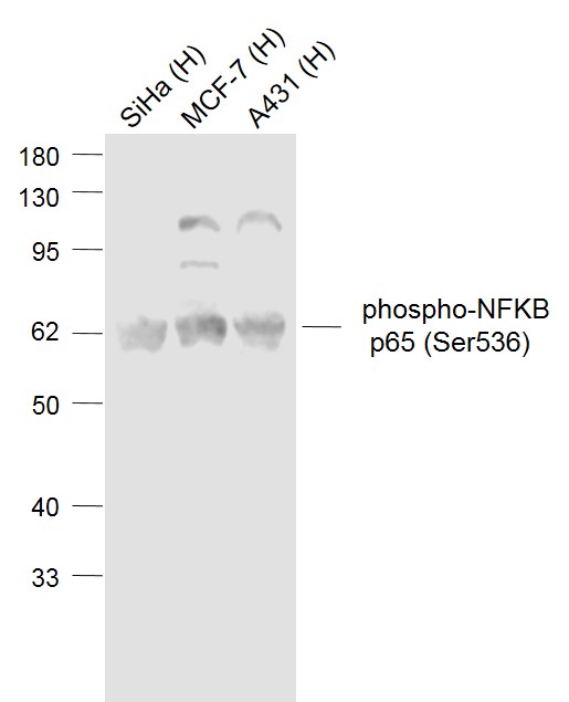 Lane 1: Human Siha cell lysates; Lane 2: Human MCF-7 cell lysates; Lane 3: Human A431 cell lysates probed with NFKB p65 Polyclonal  Antibody, Unconjugated (bs-0982R) at 1:1000 dilution and 4˚C overnight incubation. Followed by conjugated secondary antibody incubation at 1:20000 for 60 min at 37˚C.
