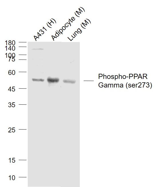 Lane 1: Human A431 cell lysates; Lane 2: Mouse Adipocyte lysates; Lane 3: Mouse Lung lysates probed with PPAR Gamma Polyclonal Antibody, Unconjugated (bs-4888R) at 1:1000 dilution and 4˚C overnight incubation. Followed by conjugated secondary antibody incubation at 1:20000 for 60 min at 37˚C.