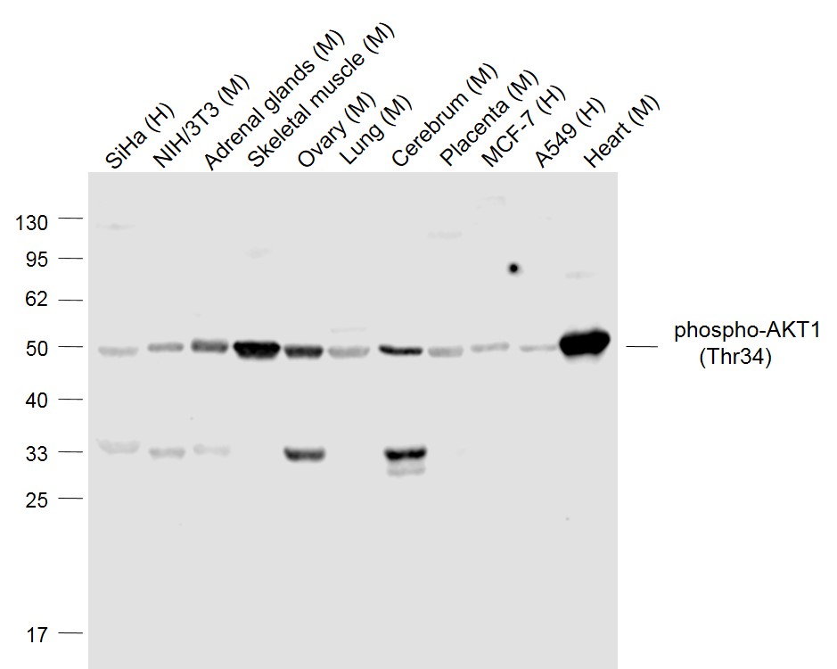 Lane 1: Human Siha cell lysates; Lane 2: Mouse NIH/3T3 cell lysates; Lane 3: Mouse Adrenal gland lysates; Lane 4: Mouse Skeletal muscle lysates; Lane 5: Mouse Ovary lysates; Lane 6: Mouse Lung lysates; Lane 7: Mouse Cerebrum lysates; Lane 8: Mouse Placenta lysates; Lane 9: Human MCF-7 cell lysates; Lane 10: Human A549 cell lysates; Lane 11: Mouse Heart cell lysates probed with AKT1 Polyclonal Antibody, Unconjugated (bs-5194R) at 1:1000 dilution and 4˚C overnight incubation. Followed by conjugated secondary antibody incubation at 1:20000 for 60 min at 37˚C.