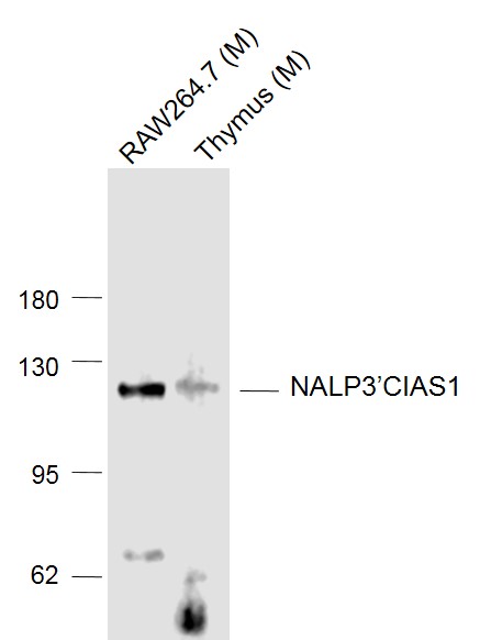 Lane 1: Mouse RAW264.7 cell lysates; Lane 2: Mouse Thymus lysates probed with Cryopyrin Polyclonal Antibody, Unconjugated (bs-10021R) at 1:1000 dilution and 4˚C overnight incubation. Followed by conjugated secondary antibody incubation at 1:20000 for 60 min at 37˚C
