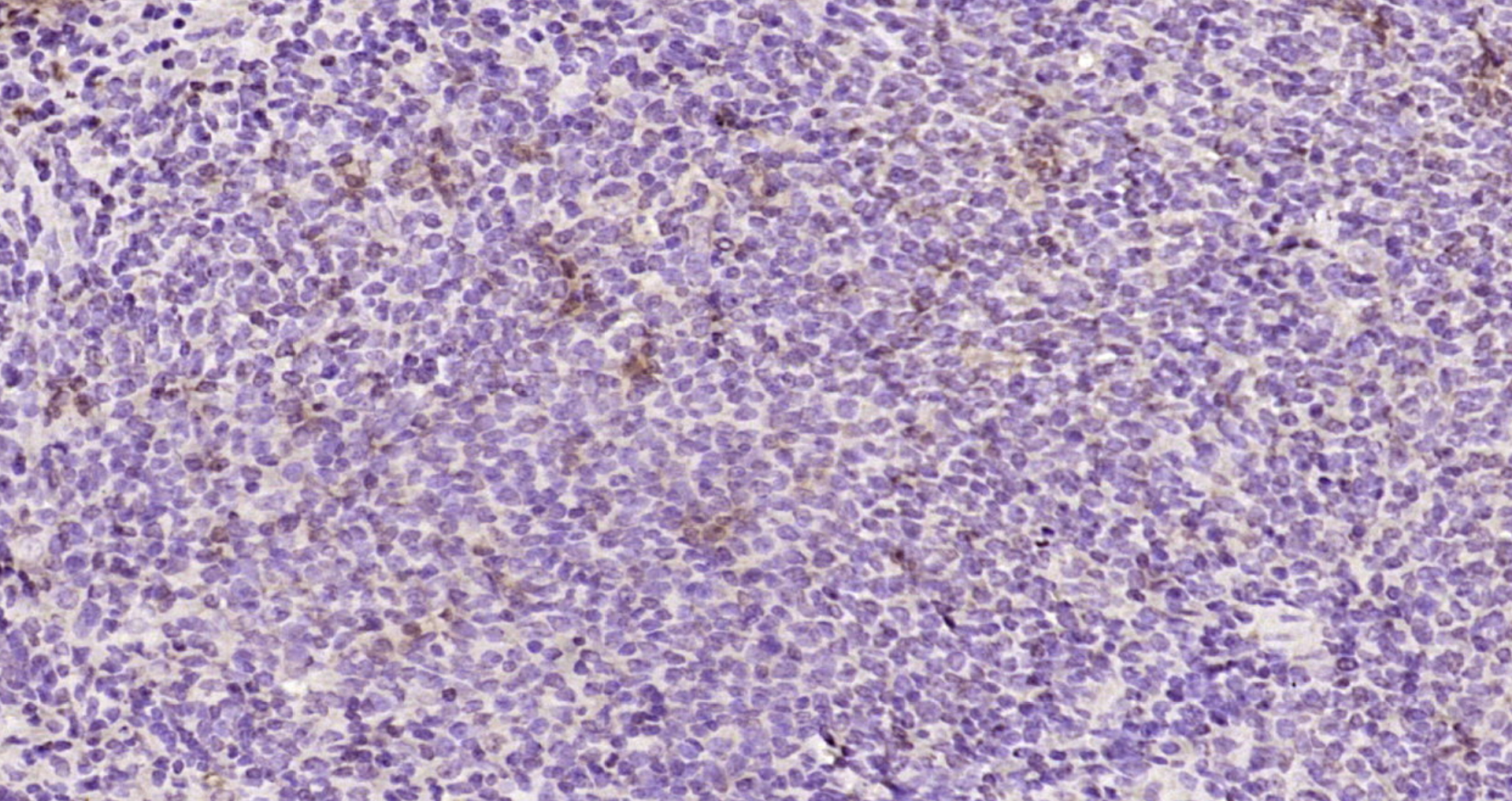 Paraformaldehyde-fixed, paraffin embedded Rat spleen; Antigen retrieval by boiling in sodium citrate buffer (pH6.0) for 15min; Block endogenous peroxidase by 3% hydrogen peroxide for 20 minutes; Blocking buffer (normal goat serum) at 37°C for 30min; Antibody incubation with E2EPF Polyclonal Antibody, Unconjugated (bs-2305R) at 1:200 overnight at 4°C, DAB staining. Paraformaldehyde-fixed, paraffin embedded Rat spleen; Antigen retrieval by boiling in sodium citrate buffer (pH6.0) for 15min; Block endogenous peroxidase by 3% hydrogen peroxide for 20 minutes; Blocking buffer (normal goat serum) at 37°C for 30min; Antibody incubation with E2EPF Polyclonal Antibody, Unconjugated (bs-2305R) at 1:200 overnight at 4°C, DAB staining.