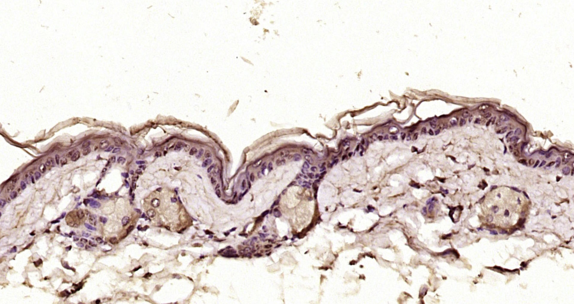 Paraformaldehyde-fixed, paraffin embedded Mouse skin; Antigen retrieval by boiling in sodium citrate buffer (pH6.0) for 15min; Block endogenous peroxidase by 3% hydrogen peroxide for 20 minutes; Blocking buffer (normal goat serum) at 37°C for 30min; Antibody incubation with Axin1 Polyclonal Antibody, Unconjugated (bs-2439R) at 1:200 overnight at 4°C, DAB staining.