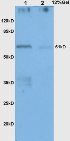 L1 human colon carcinoma lysates L2 human gastric carcinoma lysates probed with Anti CHK2 Polyclonal Antibody, Unconjugated (bs-1391R) at 1:200 in 4˚C. Followed by conjugation to secondary antibody (bs-0295G-HRP) at 1:3000 90min in 37˚C. Predicted band 61kD. Observed band size: 61kD