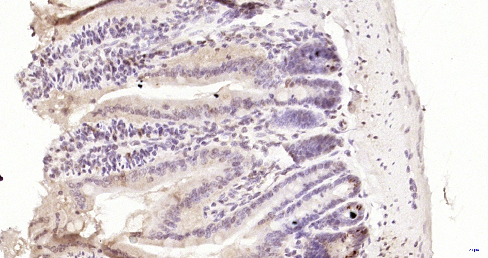 Paraformaldehyde-fixed, paraffin embedded Rat intestine; Antigen retrieval by boiling in sodium citrate buffer (pH6.0) for 15min; Block endogenous peroxidase by 3% hydrogen peroxide for 20 minutes; Blocking buffer (normal goat serum) at 37°C for 30min; Antibody incubation with IL-15RA Polyclonal Antibody, Unconjugated (bs-2605R) at 1:200 overnight at 4°C, DAB staining.
