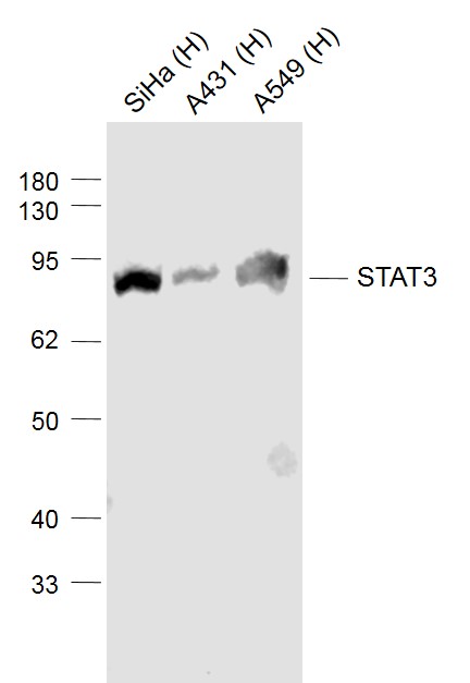 Lane 1: Human Siha cell lysates; Lane 2:  Human A431 cell lysates; Lane 3:  Human A549 cell lysates probed with STAT3 Monoclonal Antibody, Unconjugated (bsm-33218M ) at 1:1000 dilution and 4˚C overnight incubation. Followed by conjugated secondary antibody incubation at 1:20000 for 60 min at 37˚C.