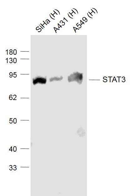 Lane 1: Human Siha cell lysates; Lane 2: Human A431 cell lysates; Lane 3: Human A549 cell lysates probed with STAT3 Monoclonal Antibody, Unconjugated (bsm-33218M ) at 1:1000 dilution and 4˚C overnight incubation. Followed by conjugated secondary antibody incubation at 1:20000 for 60 min at 37˚C.