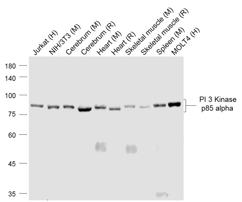 Lane 1: Human Jurkatcell lysates; Lane 2: Mouse NIH/3T3 cell lysates; Lane 3: Mouse Cerebrum lysates; Lane 4: Rat Cerebrum lysates; Lane 5: Mouse Heart lysates; Lane 6: Rat Heart lysates; Lane 7: Mouse Skeletal muscle lysates; Lane 8: Rat Skeletal muscle lysates; Lane 9: Mouse Spleen lysates; Lane 10: Human MOLT-4 cell lysates probed with PI3K p85 Monoclonal Antibody, Unconjugated (bsm-33219M ) at 1:1000 dilution and 4˚C overnight incubation. Followed by conjugated secondary antibody incubation at 1:20000 for 60 min at 37˚C.