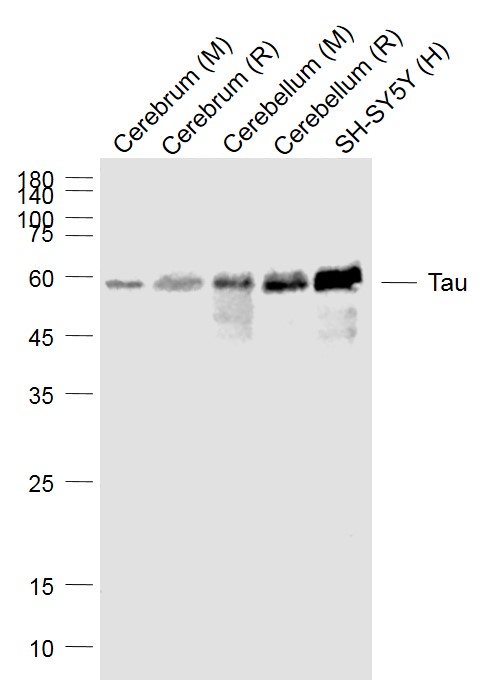 Lane 1: Mouse Cerebrum cell lysates; Lane 2: Rat Cerebrum lysates; Lane 3: Mouse Cerebellum lysates; Lane 4: Rat Cerebellum lysates; Lane 5: Human SH-SY5Y cell lysates probed with Tau Monoclonal Antibody, Unconjugated (bsm-33332M ) at 1:1000 dilution and 4˚C overnight incubation. Followed by conjugated secondary antibody incubation at 1:20000 for 60 min at 37˚C.