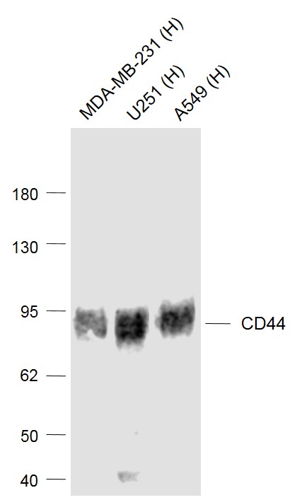 Lane 1: Human MDA-MB-231 cell lysates; Lane 2: Human U251 cell lysates; Lane 3: Human A549 cell lysates probed with CD44 Monoclonal Antibody, Unconjugated (bsm-51065M ) at 1:1000 dilution and 4˚C overnight incubation. Followed by conjugated secondary antibody incubation at 1:20000 for 60 min at 37˚C.