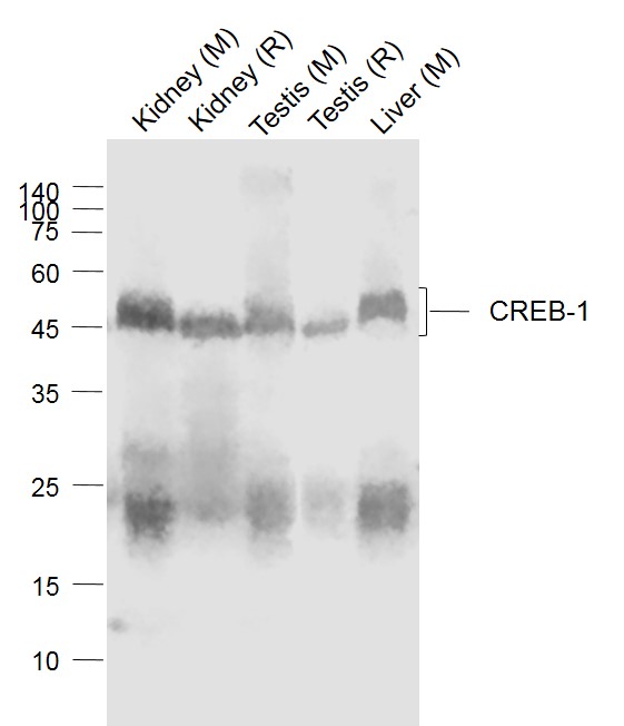 Lane 1: Mouse Kidney  lysates; Lane 2: Rat Kidney lysates; Lane 3: Mouse Testis lysates; Lane 4: Rat Testis lysates; Lane 5: Mouse Liver  lysates probed with CREB-1 Polyclonal  Antibody, Unconjugated (bs-0035M)at 1:1000 dilution and 4°C overnight incubation. Followed by conjugated secondary antibody incubation at 1:20000 for 60 min at 37°C.