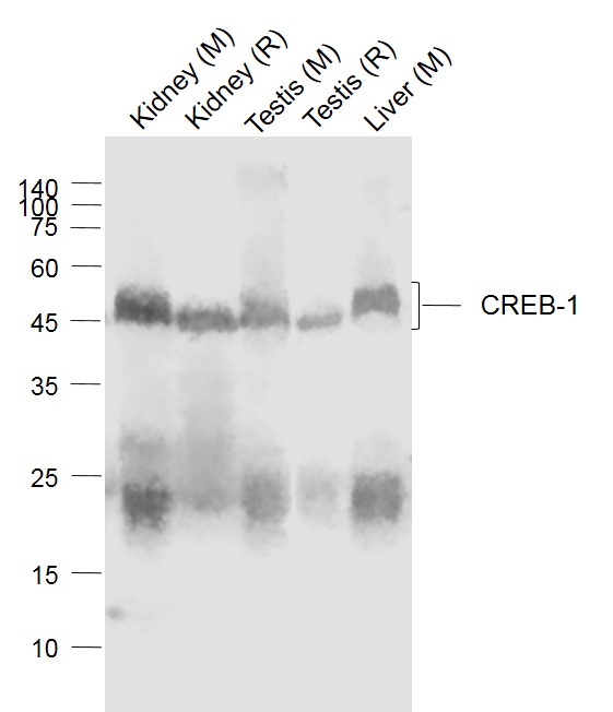 Lane 1: Mouse Kidney lysates; Lane 2: Rat Kidney lysates; Lane 3: Mouse Testis lysates; Lane 4: Rat Testis lysates; Lane 5: Mouse Liver lysates probed with CREB-1 Polyclonal Antibody, Unconjugated (bs-0035M)at 1:1000 dilution and 4˚C overnight incubation. Followed by conjugated secondary antibody incubation at 1:20000 for 60 min at 37˚C.