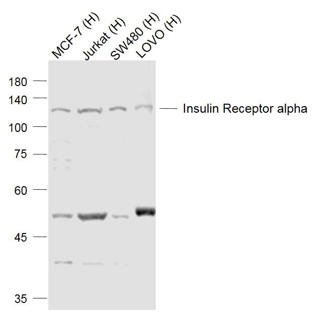 Lane 1: Human MCF-7 cell lysates; Lane 2: Human Jurkat cell lysates; Lane 3: Human SW480 cell lysates; Lane 4: Human LOVO cell lysates probed with Insulin Receptor alpha Polyclonal Antibody, Unconjugated (bs-0047R) at 1:500dilution and 4˚C overnight incubation. Followed by conjugated secondary antibody incubation at 1:20000 for 60 min at 37˚C.