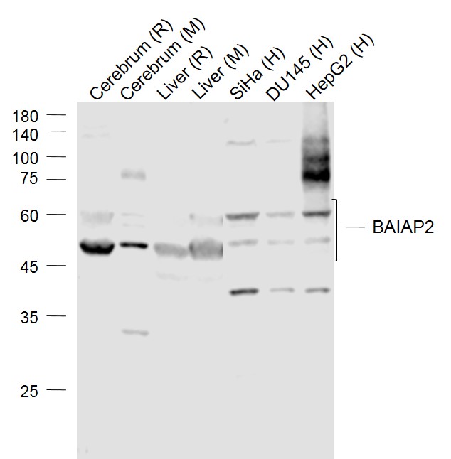 Lane 1: Rat Cerebrum lysates; Lane 2: Mouse Cerebrum lysates; Lane 3: Rat Liver lysates; Lane 4: Mouse Liver lysates; Lane 5: Human Siha cell lysates; Lane 6: Human DU145 cell lysates; Lane 7: Human HepG2 cell lysates probed with BAIAP2 Polyclonal Antibody, Unconjugated (bs-0242R) at 1:500 dilution and 4˚C overnight incubation. Followed by conjugated secondary antibody incubation at 1:20000 for 60 min at 37˚C.