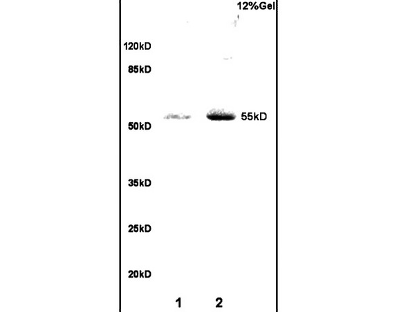 Lane 1: mouse embryo lysates Lane 2: human colon carcinoma lysates probed with Anti RBPJK/RBP-J Polyclonal Antibody, Unconjugated (bs-2966R) at 1:200 in 4C. Followed by conjugation to secondary antibody (bs-0295G-HRP) at 1:3000 90min in 37C. Predicted band 55kD. Observed band size: 55kD