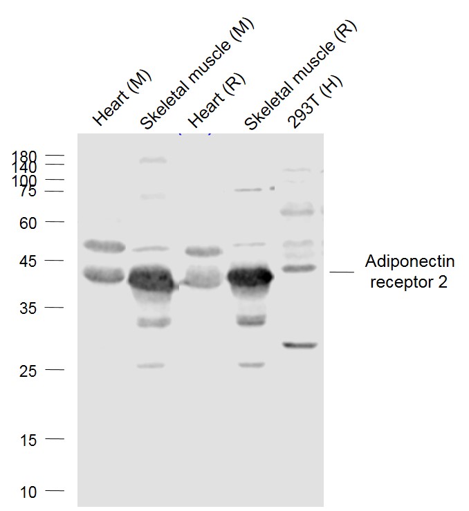 Lane 1: Mouse Heart lysates; Lane 2: Mouse Skeletal muscle lysates; Lane 3: Rat Heart lysates; Lane 4: Rat Skeletal muscle lysates; Lane 5: Human 293T cell lysates probed with Adiponectin receptor 2 Polyclonal Antibody, Unconjugated (bs-0611R) at 1:1000 dilution and 4˚C overnight incubation. Followed by conjugated secondary antibody incubation at 1:20000 for 60 min at 37˚C.