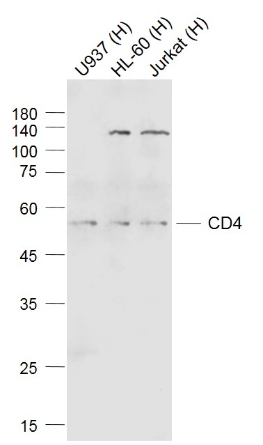 Lane 1: Human U937 cell lysates; Lane 2: Human HL-60 cell lysates; Lane 3: Human Jurkat cell lysates probed with CD4 Polyclonal  Antibody, Unconjugated (bs-0647R) at 1:1000 dilution and 4˚C overnight incubation. Followed by conjugated secondary antibody incubation at 1:20000 for 60 min at 37˚C.