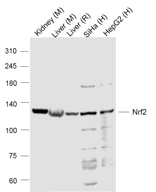 Lane 1: Mouse Kidney lysates; Lane 2: Mouse Liver lysates; Lane 3: Rat Liver lysates; Lane 4: Human Siha cell lysates; Lane 5: Human HepG2 cell lysates probed with Nrf2 Polyclonal  Antibody, Unconjugated (bs-1074R) at 1:1000 dilution and 4˚C overnight incubation. Followed by conjugated secondary antibody incubation at 1:20000 for 60 min at 37˚C.