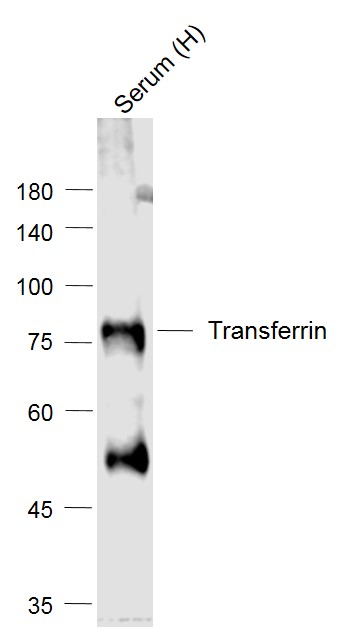 Lane 1: Human Serum probed with Transferrin Polyclonal Antibody, Unconjugated (bs-2052R) at 1:1000 dilution and 4˚C overnight incubation. Followed by conjugated secondary antibody incubation at 1:20000 for 60 min at 37˚C.