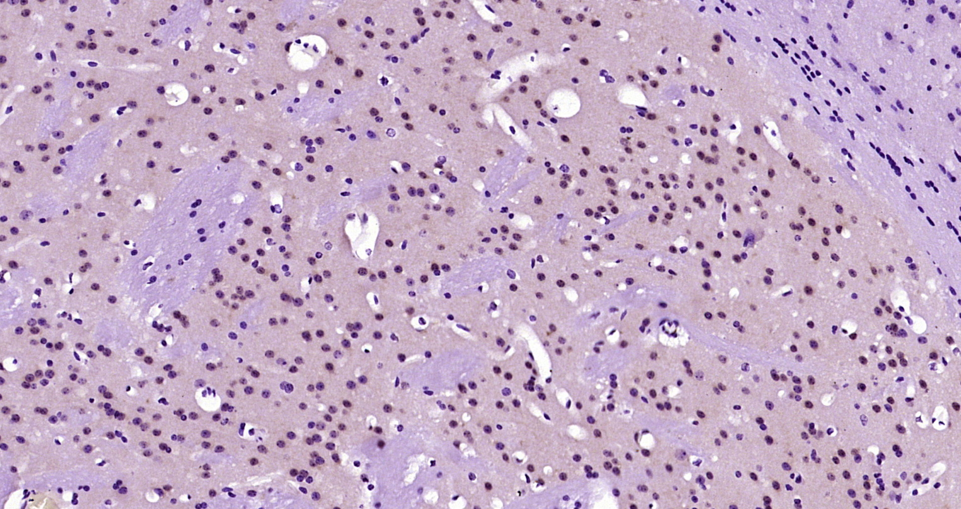 Paraformaldehyde-fixed, paraffin embedded Mouse brain; Antigen retrieval by boiling in sodium citrate buffer (pH6.0) for 15min; Block endogenous peroxidase by 3% hydrogen peroxide for 20 minutes; Blocking buffer (normal goat serum) at 37°C for 30min; Antibody incubation with KLF2 Polyclonal Antibody, Unconjugated (bs-2772R) at 1:200 overnight at 4°C, DAB staining.