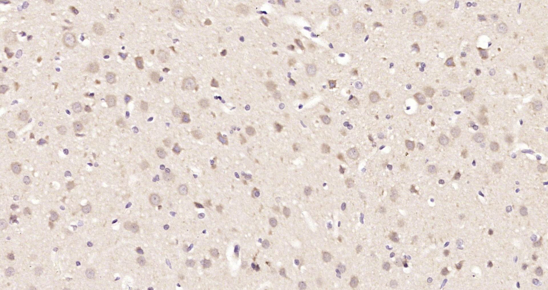 Paraformaldehyde-fixed, paraffin embedded Rat brain; Antigen retrieval by boiling in sodium citrate buffer (pH6.0) for 15min; Block endogenous peroxidase by 3% hydrogen peroxide for 20 minutes; Blocking buffer (normal goat serum) at 37°C for 30min; Antibody incubation with ATF2 (Thr69/71) Polyclonal Antibody, Unconjugated (bs-3033R) at 1:200 overnight at 4°C, DAB staining.