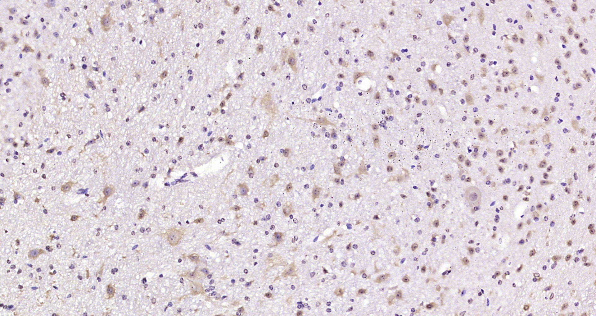 Paraformaldehyde-fixed, paraffin embedded Mouse cerebellum; Antigen retrieval by boiling in sodium citrate buffer (pH6.0) for 15min; Block endogenous peroxidase by 3% hydrogen peroxide for 20 minutes; Blocking buffer (normal goat serum) at 37°C for 30min; Antibody incubation with _x000D_ Synapsin 2 Polyclonal Antibody, Unconjugated (bs-3502R) at 1:200 overnight at 4°C, DAB staining.