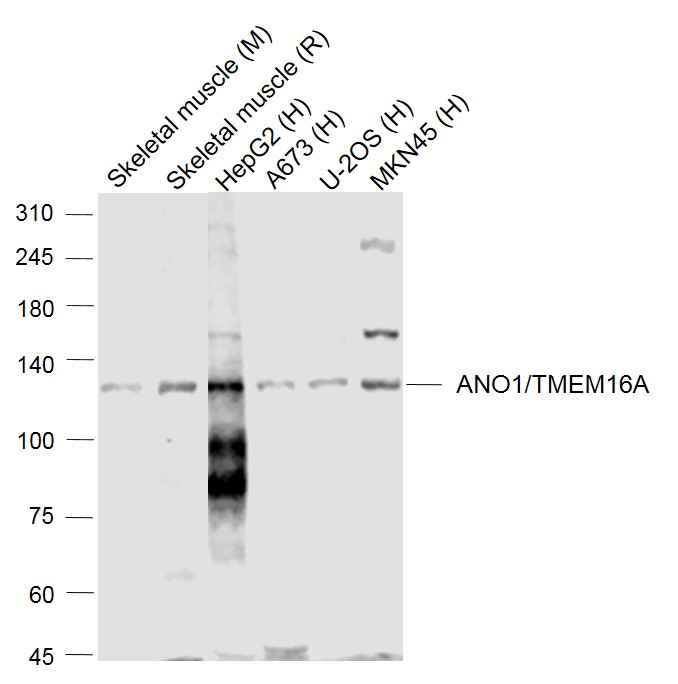 Lane 1: Mouse Skeletal muscle lysates; Lane 2: Rat Skeletal muscle lysates; Lane 3: Human HepG2 cell lysates; Lane 4: Human A673 cell lysates; Lane 5: Human U-2OS cell lysates; Lane 6: Human MKN45 cell lysates probed with TMEM16A Polyclonal Antibody, Unconjugated (bs-3794R) at 1:1000 dilution and 4˚C overnight incubation. Followed by conjugated secondary antibody incubation at 1:20000 for 60 min at 37˚C
