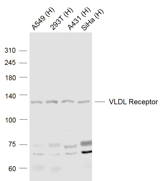 Lane 1: Human A549 cell lysates; Lane 2: Human 293T cell lysates; Lane 3: Human A431 cell lysates; Lane 4: Human Siha cell lysates probed with VLDL Receptor Polyclonal Antibody, Unconjugated (bs-4228R) at 1:1000 dilution and 4˚C overnight incubation. Followed by conjugated secondary antibody incubation at 1:20000 for 60 min at 37˚C.