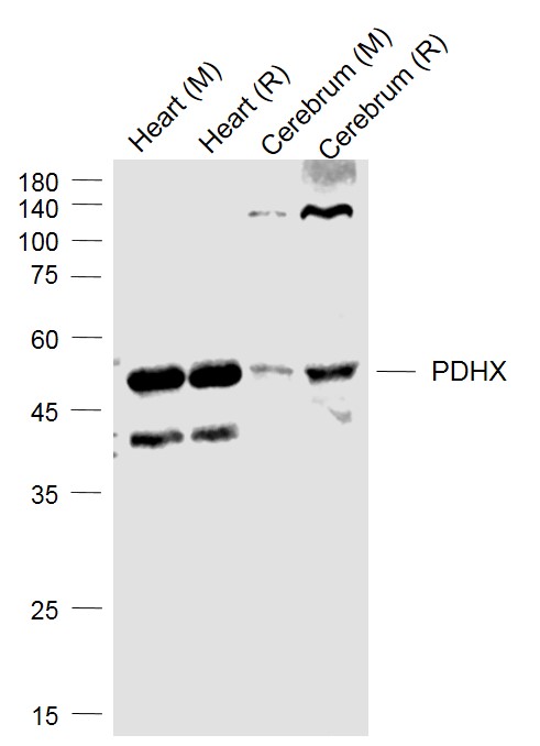 Lane 1: Mouse Heart lysates; Lane 2: Rat Heart lysates; Lane 3: Mouse Cerebrum lysates; Lane 4:Rat Cerebrum lysates probed with PDHX Polyclonal Antibody, Unconjugated (bs-5003R) at 1:1000 dilution and 4˚C overnight incubation. Followed by conjugated secondary antibody incubation at 1:20000 for 60 min at 37˚C.