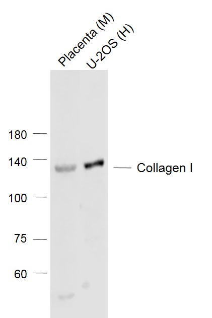 Lane 1: Mouse Placenta lysates; Lane 2: Human U-2OS cell lysates probed with Collagen 1 Polyclonal Antibody, Unconjugated (bs-10423R) at 1:1000 dilution and 4˚C overnight incubation. Followed by conjugated secondary antibody incubation at 1:20000 for 60 min at 37˚C