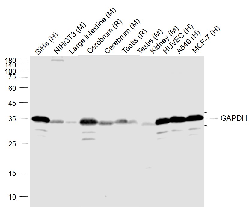 Lane 1: Human Siha cell lysates; Lane 2: Mouse NIH/3T3 cell lysates; Lane 3: Mouse Large intestine lysates; Lane 4: Rat Cerebrum lysates; Lane 5: Mouse Cerebrum lysates; Lane 6: Rat Testis lysates; Lane 7: Mouse Testis lysates; Lane 8: Mouse Kidney lysates; Lane 9: Human HUVEC cell lysates; Lane 10: Human A549 cell lysates; Lane 11: Human MCF-7 cell lysates probed with GAPDH Polyclonal Antibody, Unconjugated (bs-10900R) at 1:1000 dilution and 4˚C overnight incubation. Followed by conjugated secondary antibody incubation at 1:20000 for 60 min at 37˚C.