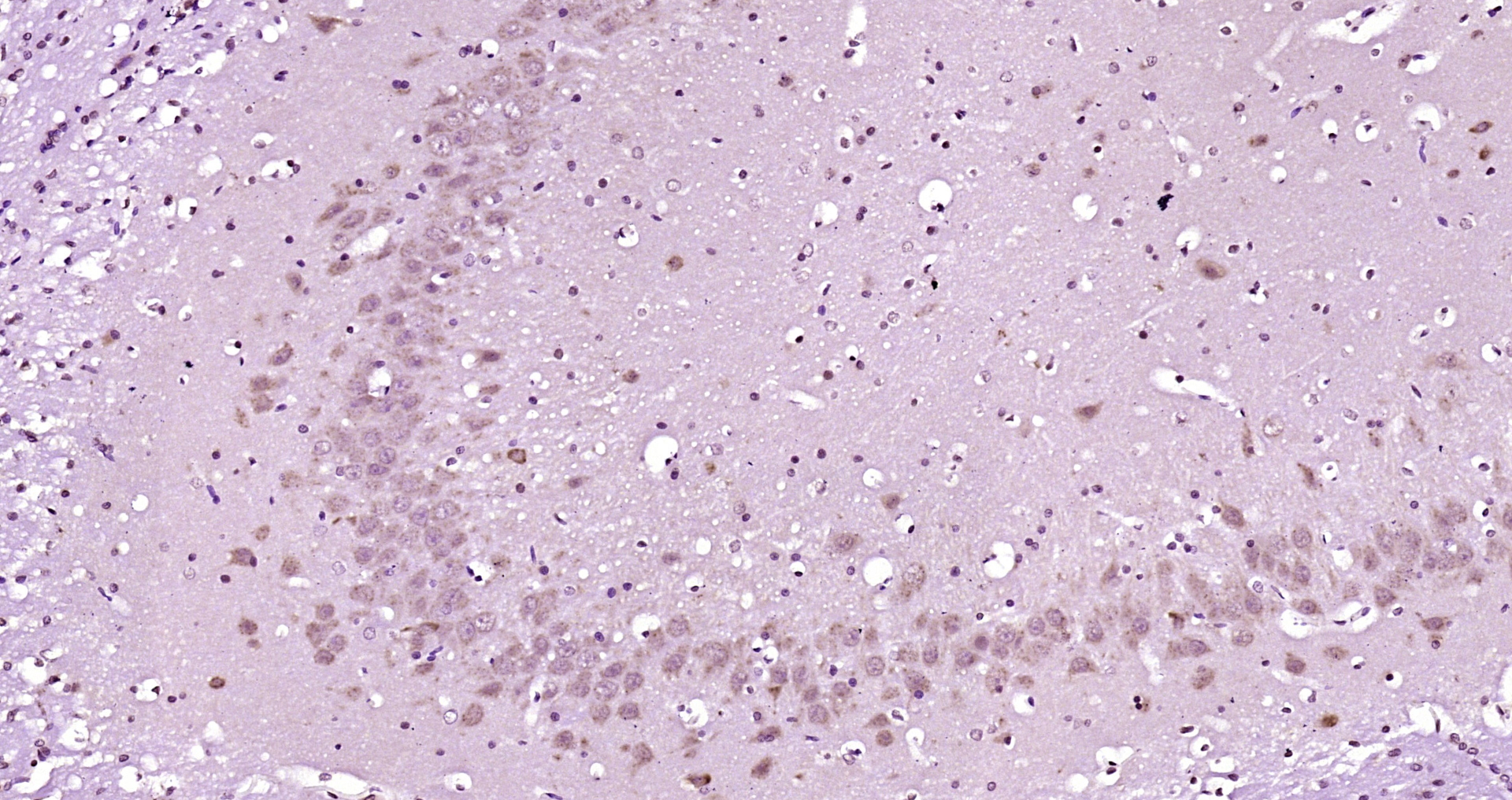 Paraformaldehyde-fixed, paraffin embedded Rat brain; Antigen retrieval by boiling in sodium citrate buffer (pH6.0) for 15min; Block endogenous peroxidase by 3% hydrogen peroxide for 20 minutes; Blocking buffer (normal goat serum) at 37°C for 30min; Antibody incubation with PRKACB(Thr198) Polyclonal Antibody, Unconjugated (bs-3725R) at 1:200 overnight at 4°C, DAB staining.