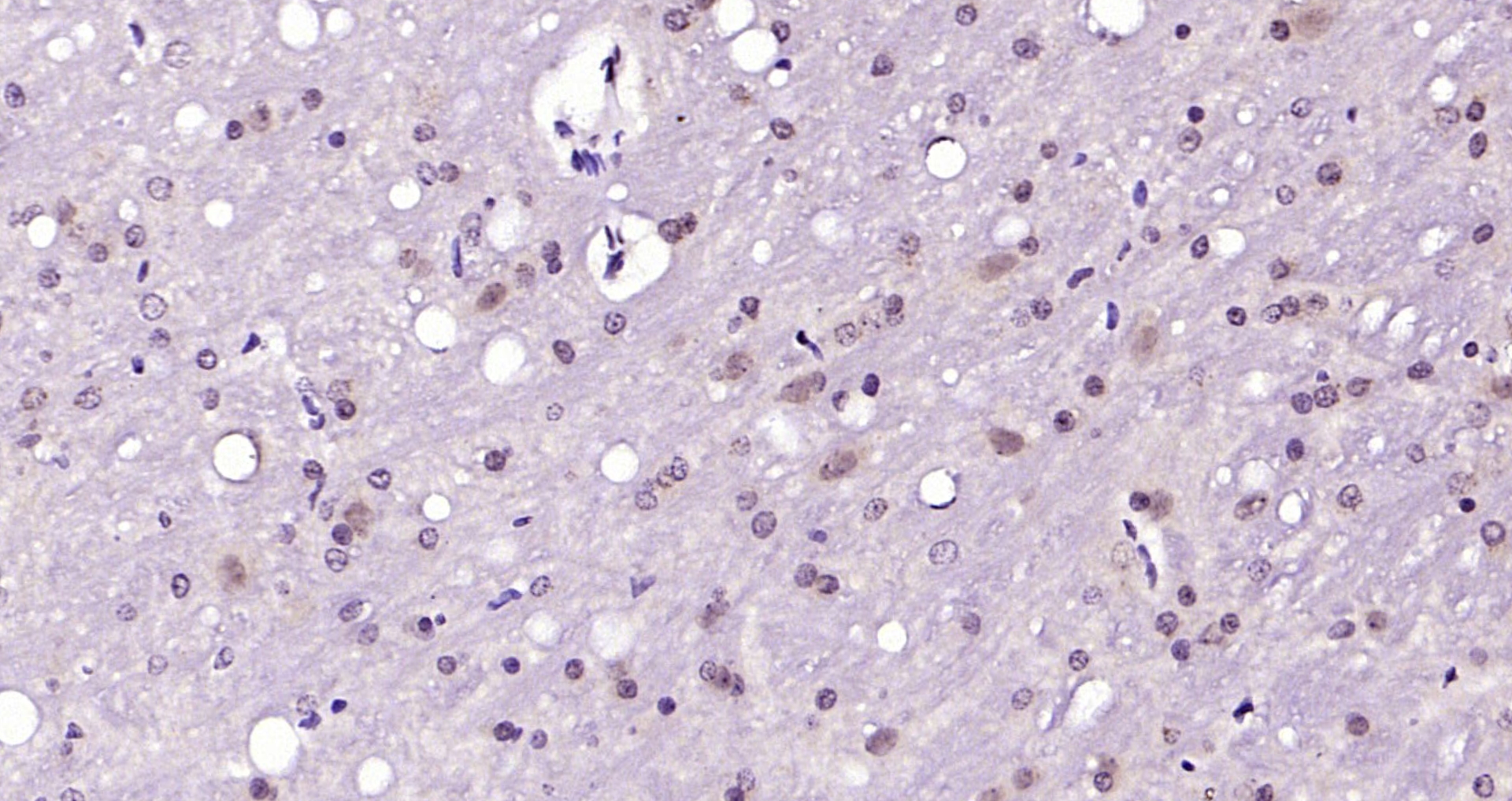 Paraformaldehyde-fixed, paraffin embedded Rat brain; Antigen retrieval by boiling in sodium citrate buffer (pH6.0) for 15min; Block endogenous peroxidase by 3% hydrogen peroxide for 20 minutes; Blocking buffer (normal goat serum) at 37°C for 30min; Antibody incubation with IRS1(Ser1101) Polyclonal Antibody, Unconjugated (bs-3197R) at 1:200 overnight at 4°C, DAB staining.