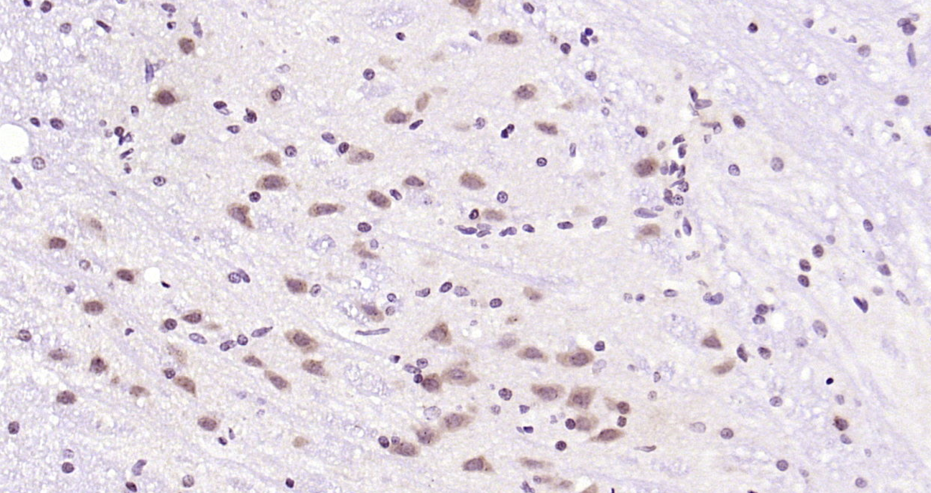 Paraformaldehyde-fixed, paraffin embedded Rat cerebellum; Antigen retrieval by boiling in sodium citrate buffer (pH6.0) for 15min; Block endogenous peroxidase by 3% hydrogen peroxide for 20 minutes; Blocking buffer (normal goat serum) at 37°C for 30min; Antibody incubation with IRS1(Ser1101) Polyclonal Antibody, Unconjugated (bs-3197R) at 1:200 overnight at 4°C, DAB staining.